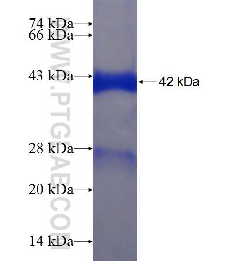 MGAT1 fusion protein Ag7470 SDS-PAGE