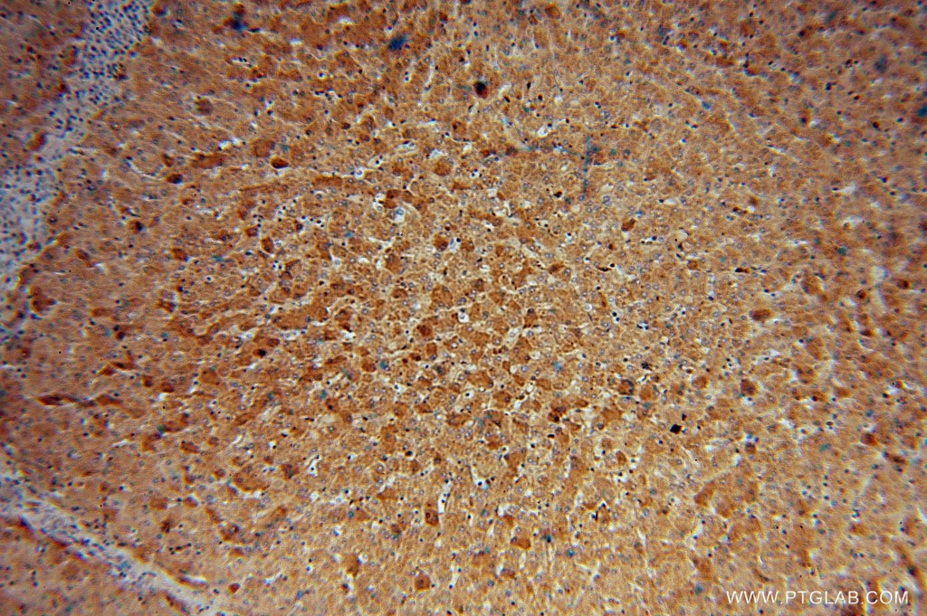 Immunohistochemistry (IHC) staining of human liver tissue using MGAT2 Polyclonal antibody (15772-1-AP)