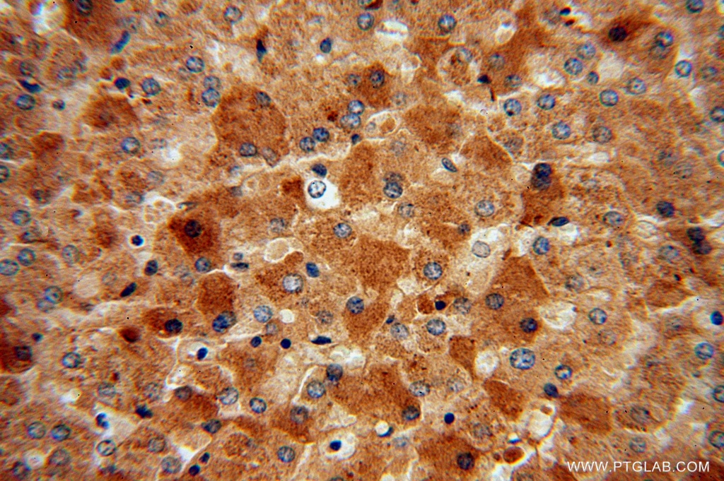 Immunohistochemistry (IHC) staining of human liver tissue using MGAT2 Polyclonal antibody (15772-1-AP)