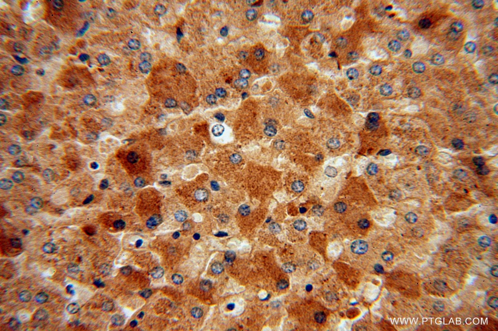 IHC staining of human liver using 15772-1-AP