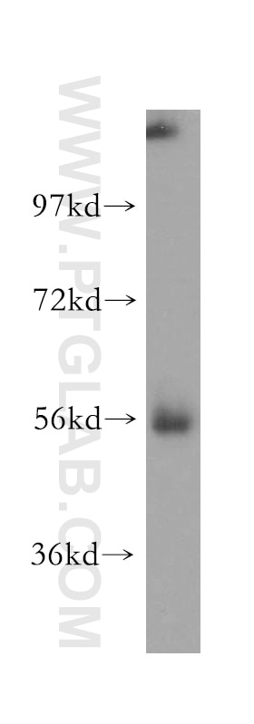 Western Blot (WB) analysis of human liver tissue using MGAT2 Polyclonal antibody (15772-1-AP)