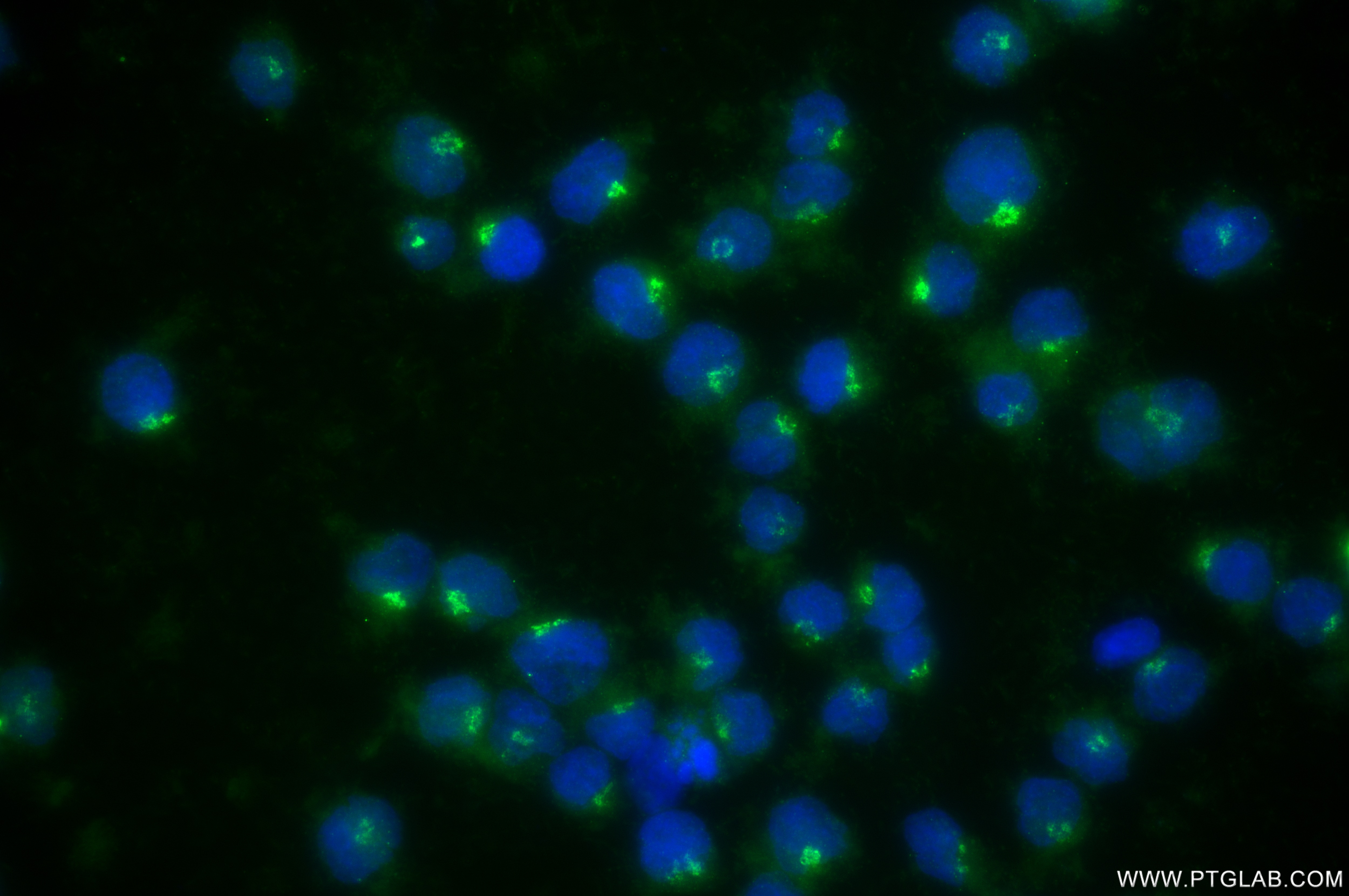 Immunofluorescence (IF) / fluorescent staining of Raji cells using MGAT2 Recombinant antibody (85933-1-RR)
