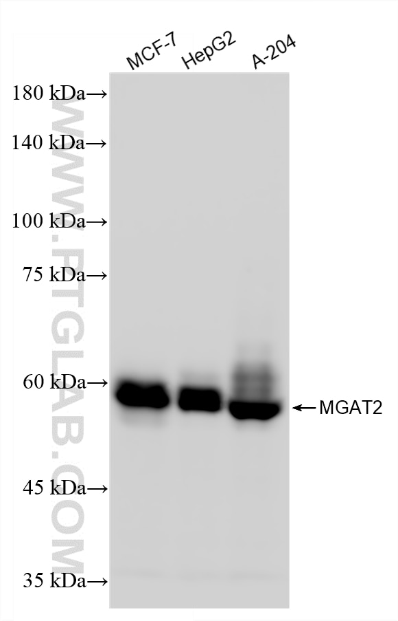 Western Blot (WB) analysis of various lysates using MGAT2 Recombinant antibody (85933-1-RR)