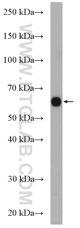 Western Blot (WB) analysis of COLO 320 cells using MGAT3 Polyclonal antibody (17869-1-AP)