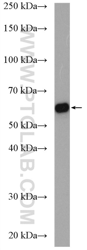 Western Blot (WB) analysis of Caco-2 cells using MGAT3 Polyclonal antibody (17869-1-AP)