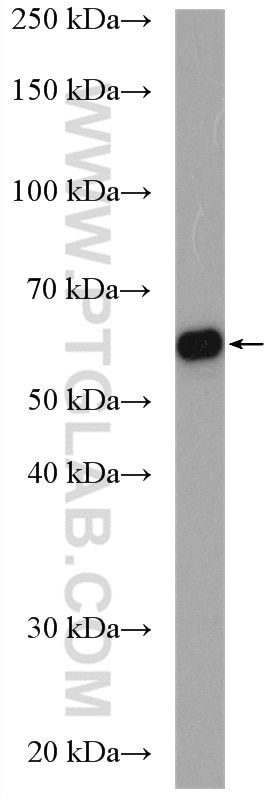 WB analysis of Caco-2 using 17869-1-AP