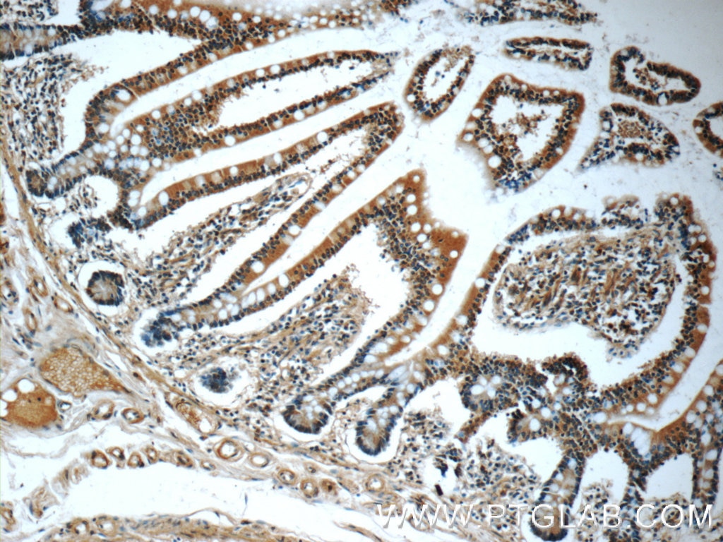 Immunohistochemistry (IHC) staining of human small intestine tissue using MGAT4A Polyclonal antibody (25109-1-AP)