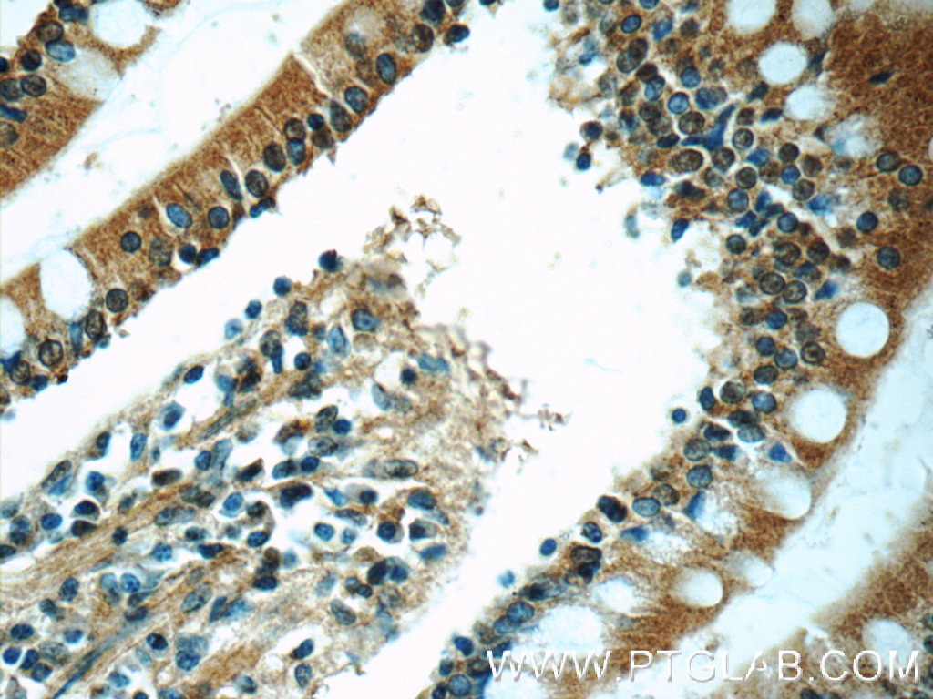 Immunohistochemistry (IHC) staining of human small intestine tissue using MGAT4A Polyclonal antibody (25109-1-AP)