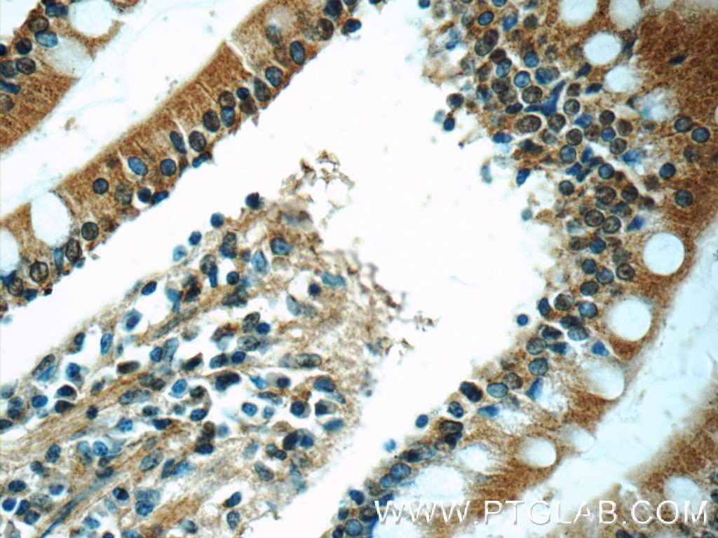 IHC staining of human small intestine using 25109-1-AP