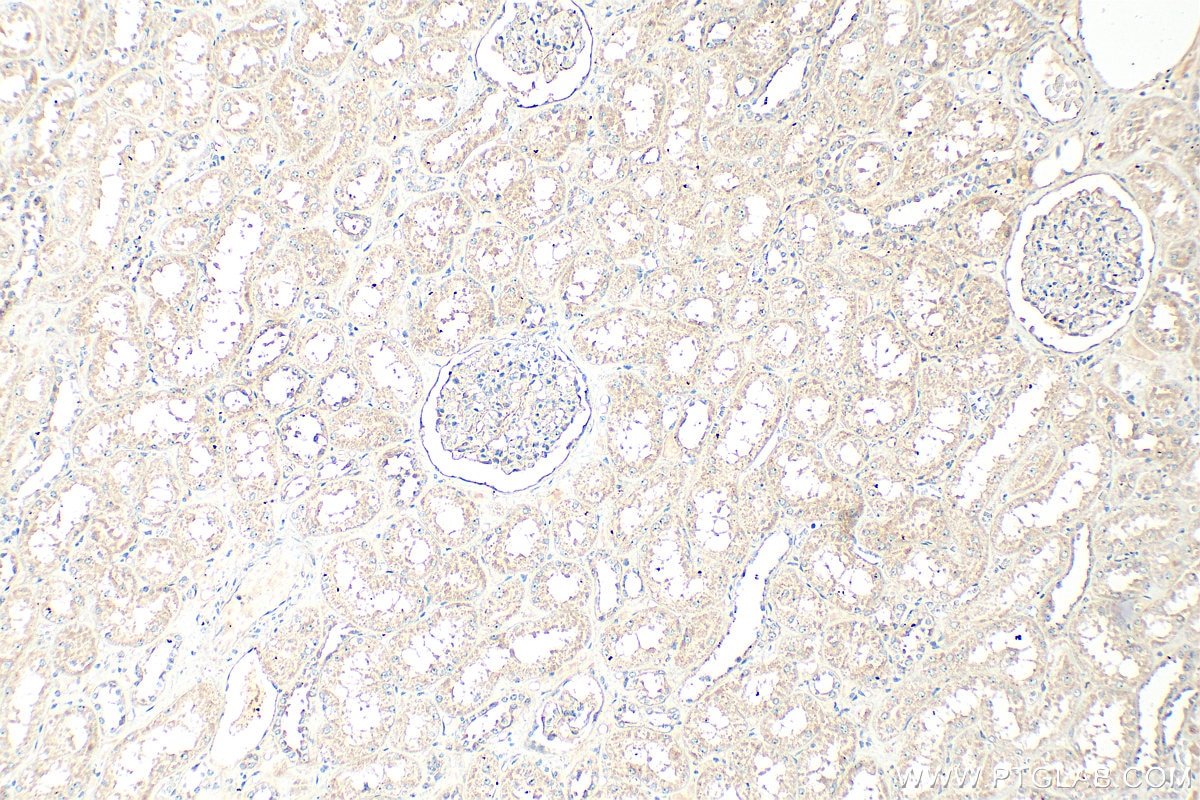 Immunohistochemistry (IHC) staining of human kidney tissue using MGAT4A Polyclonal antibody (25109-1-AP)