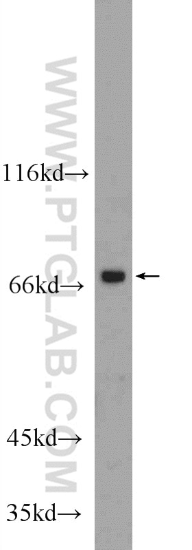 Western Blot (WB) analysis of HeLa cells using MGAT4A Polyclonal antibody (25109-1-AP)