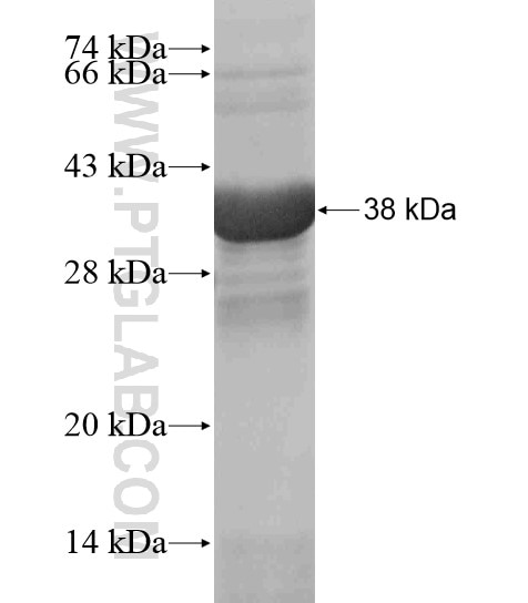 MGAT4A fusion protein Ag18956 SDS-PAGE