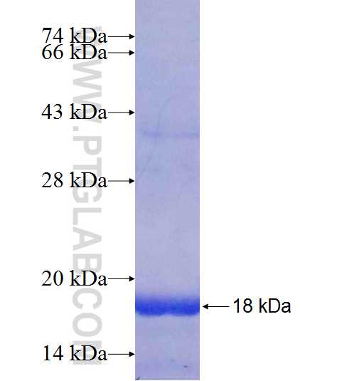 MGAT4A fusion protein Ag19003 SDS-PAGE