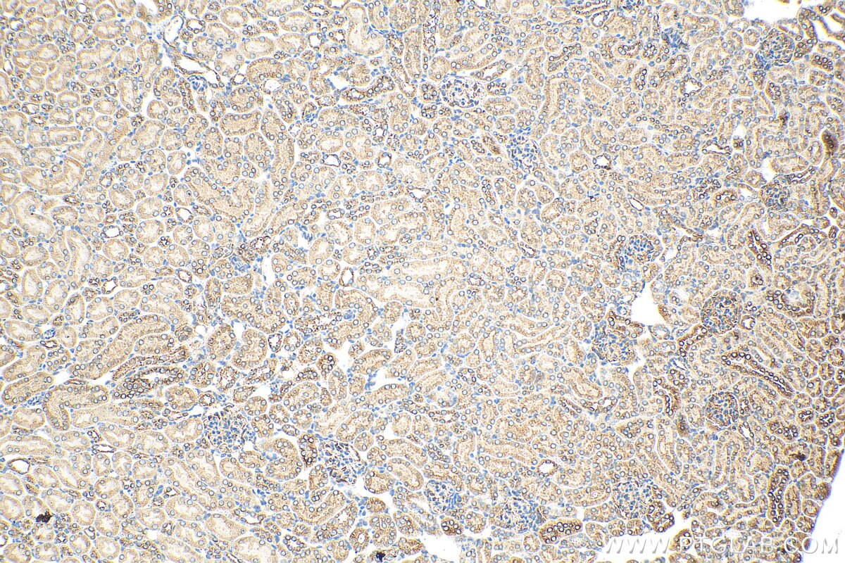 Immunohistochemistry (IHC) staining of mouse kidney tissue using MGAT4B Polyclonal antibody (30718-1-AP)