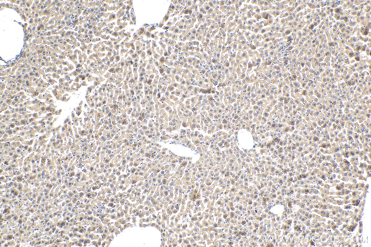 Immunohistochemistry (IHC) staining of mouse liver tissue using MGAT4B Polyclonal antibody (30718-1-AP)