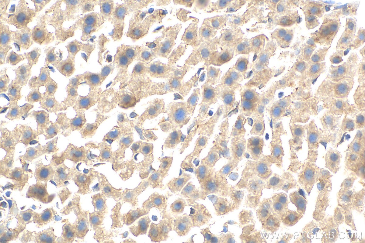 Immunohistochemistry (IHC) staining of mouse liver tissue using MGAT4B Polyclonal antibody (30718-1-AP)