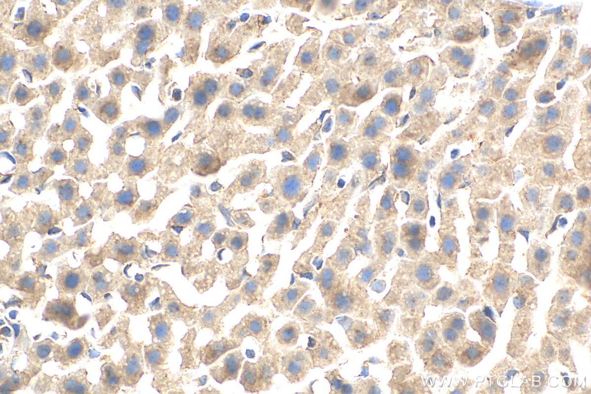 IHC staining of mouse liver using 30718-1-AP