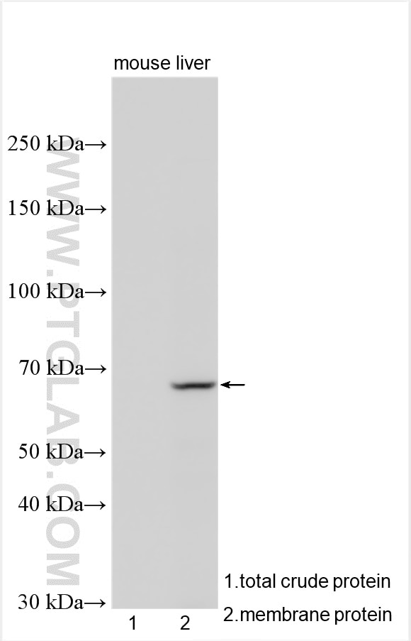 Western Blot (WB) analysis of various lysates using MGAT4B Polyclonal antibody (30718-1-AP)