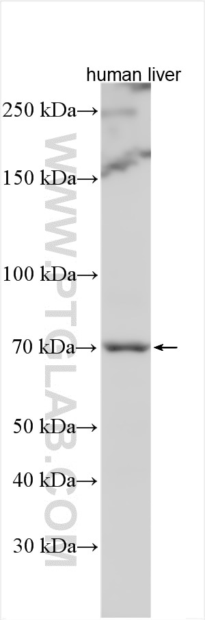 Western Blot (WB) analysis of various lysates using MGAT4B Polyclonal antibody (30718-1-AP)