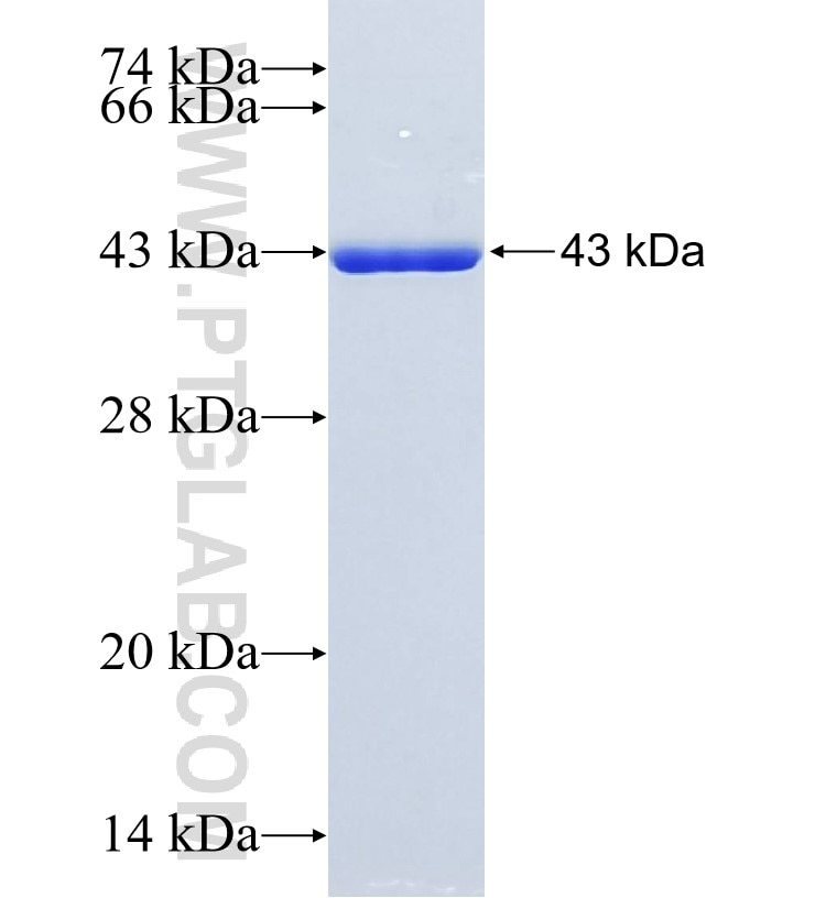 MGAT4B fusion protein Ag33769 SDS-PAGE