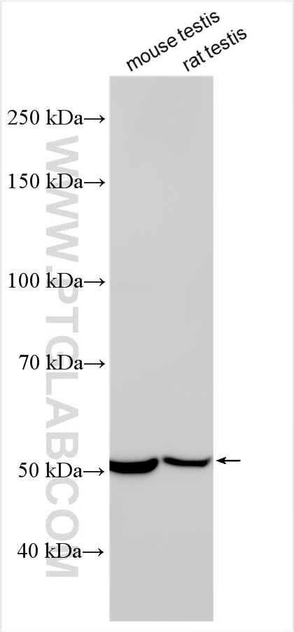 Western Blot (WB) analysis of various lysates using MGAT4C Polyclonal antibody (17841-1-AP)