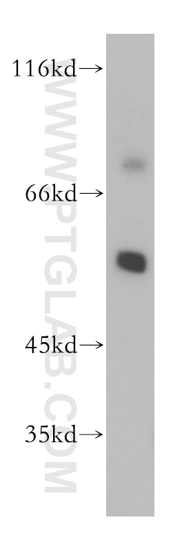 Western Blot (WB) analysis of SH-SY5Y cells using MGAT4C Polyclonal antibody (17841-1-AP)