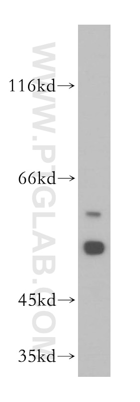 Western Blot (WB) analysis of mouse testis tissue using MGAT4C Polyclonal antibody (17841-1-AP)