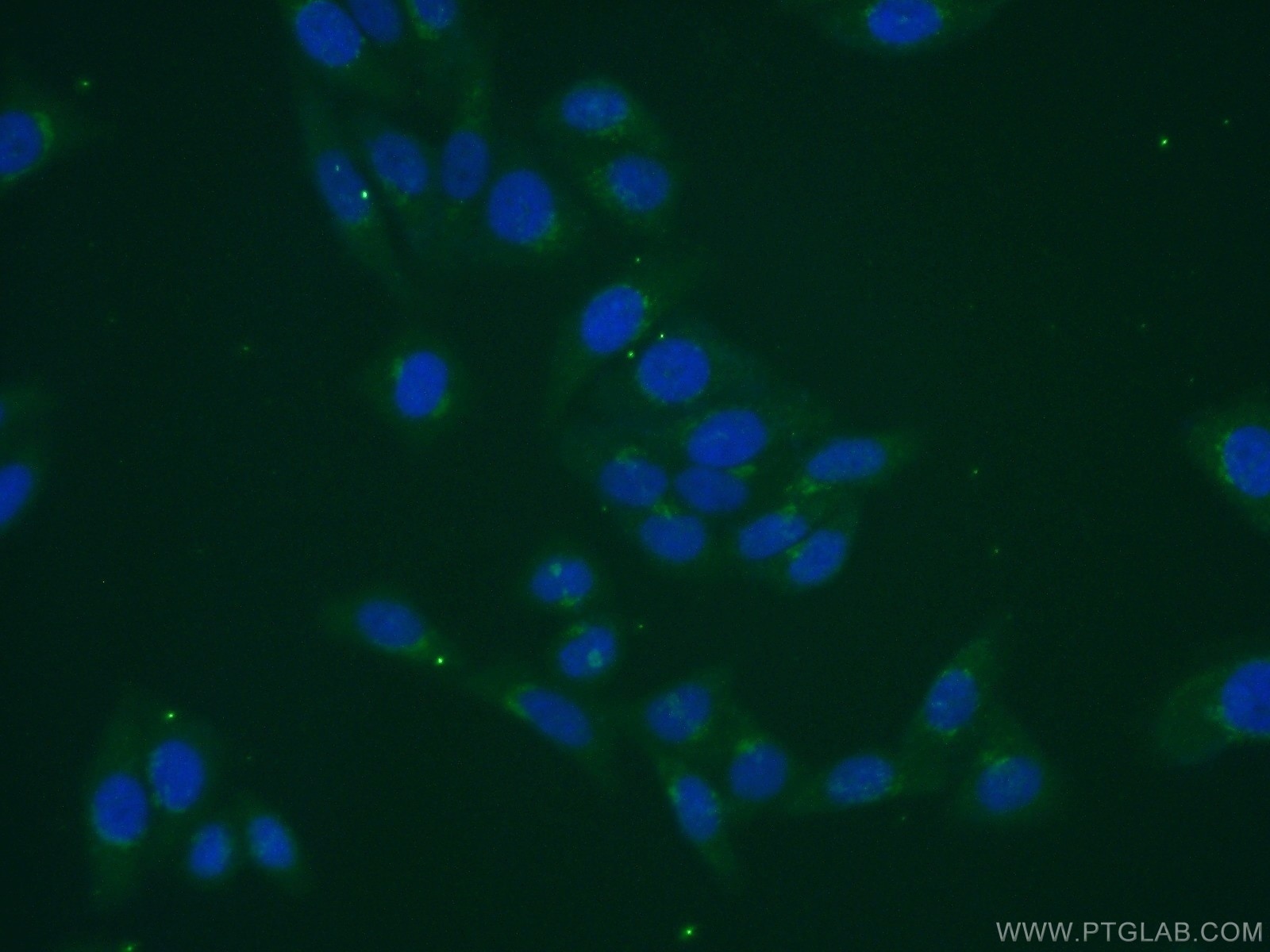 Immunofluorescence (IF) / fluorescent staining of HepG2 cells using MGAT5B Polyclonal antibody (16993-1-AP)