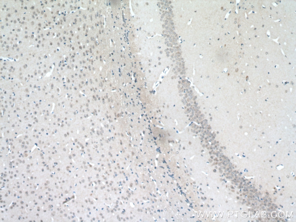 Immunohistochemistry (IHC) staining of mouse brain tissue using MGAT5B Polyclonal antibody (16993-1-AP)