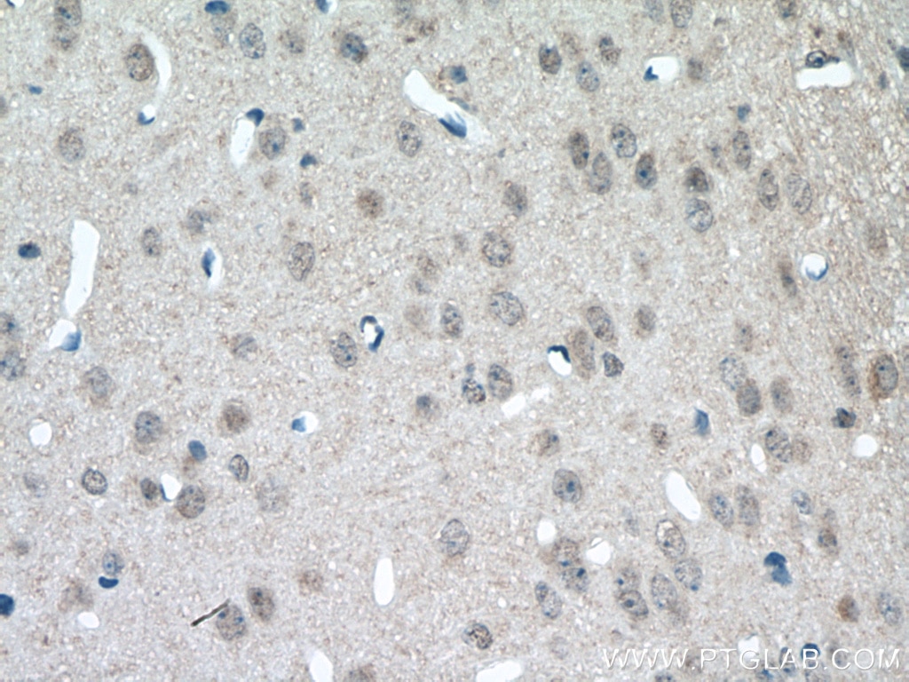 Immunohistochemistry (IHC) staining of mouse brain tissue using MGAT5B Polyclonal antibody (16993-1-AP)