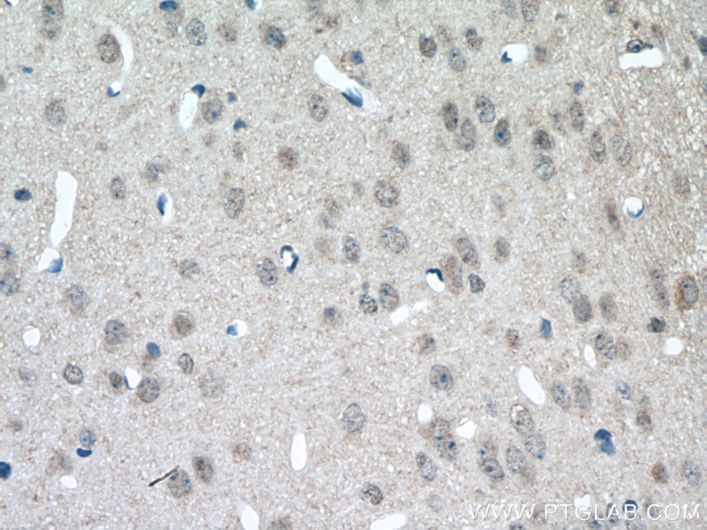 IHC staining of mouse brain using 16993-1-AP