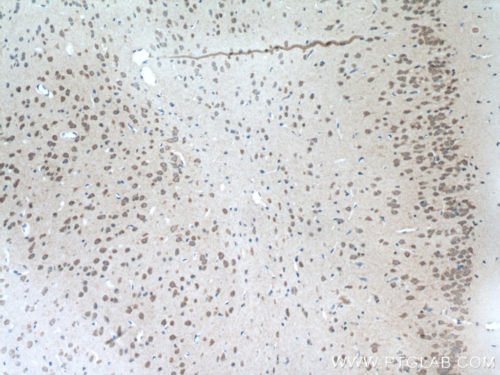 IHC staining of mouse brain using 16993-1-AP