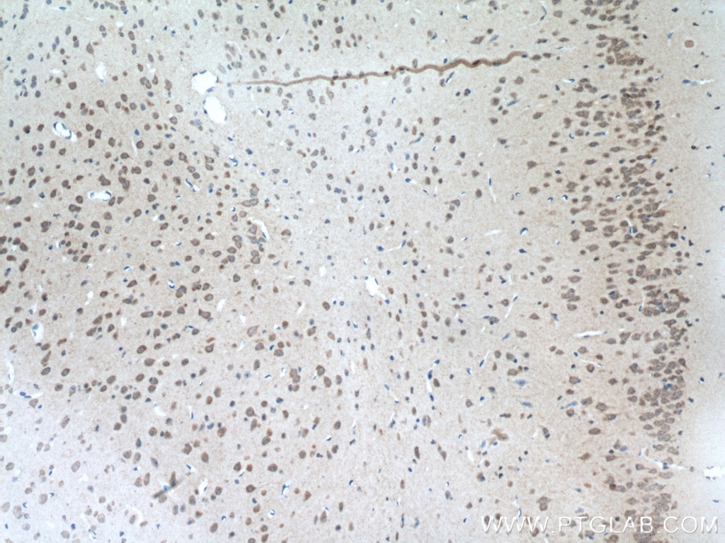 Immunohistochemistry (IHC) staining of mouse brain tissue using MGAT5B Polyclonal antibody (16993-1-AP)