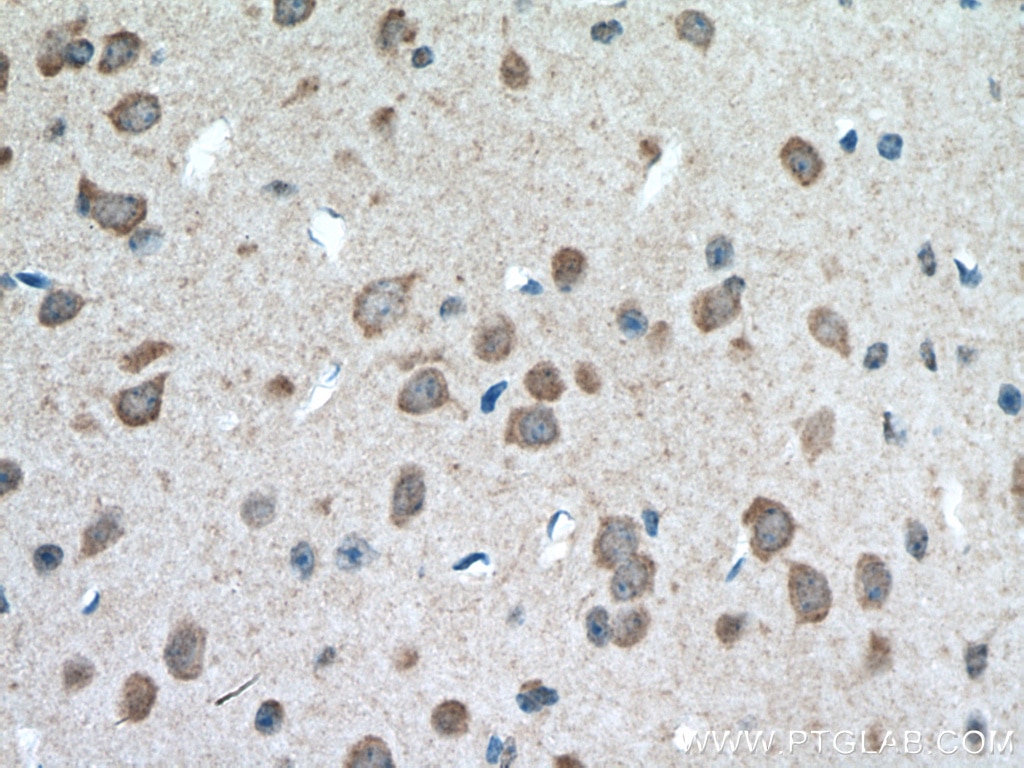 Immunohistochemistry (IHC) staining of mouse brain tissue using MGAT5B Polyclonal antibody (16993-1-AP)