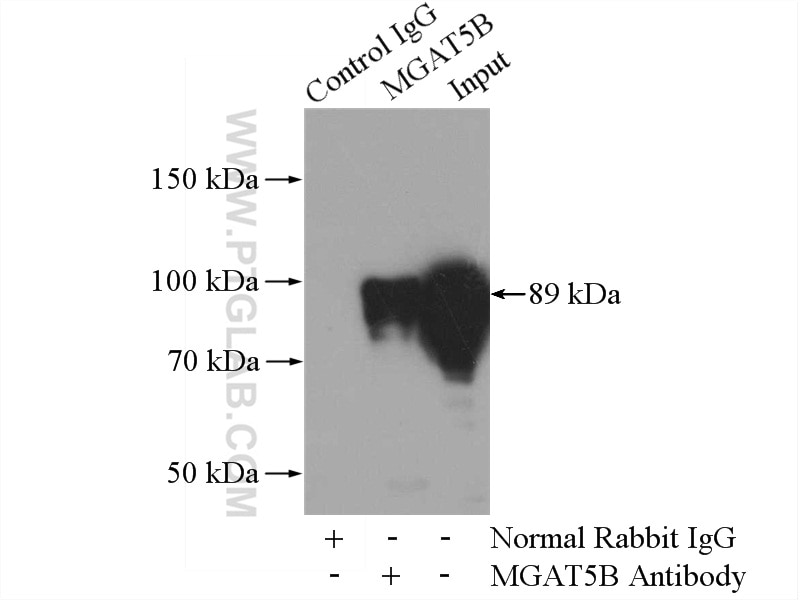 Immunoprecipitation (IP) experiment of Jurkat cells using MGAT5B Polyclonal antibody (16993-1-AP)