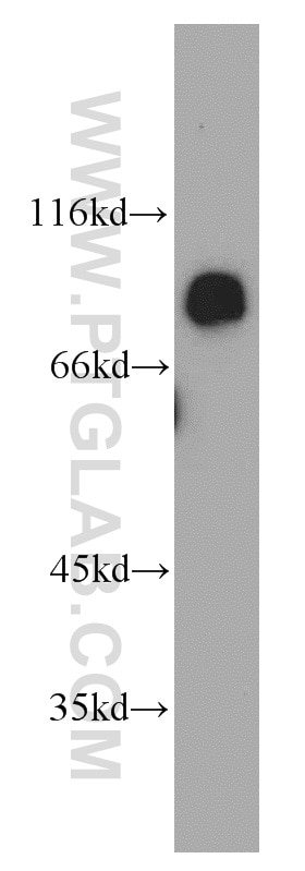 Western Blot (WB) analysis of HepG2 cells using MGAT5B Polyclonal antibody (16993-1-AP)