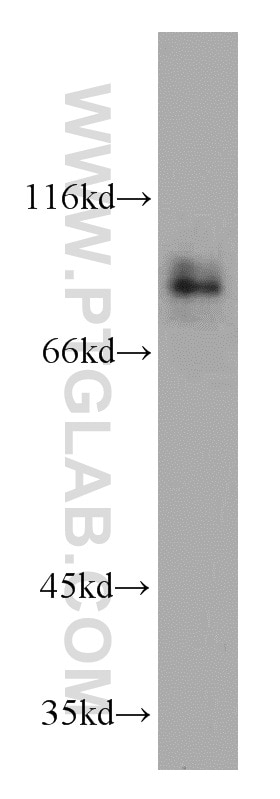 Western Blot (WB) analysis of SH-SY5Y cells using MGAT5B Polyclonal antibody (16993-1-AP)