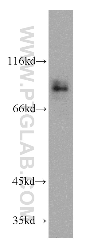 WB analysis of SH-SY5Y using 16993-1-AP