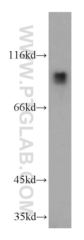 Western Blot (WB) analysis of MCF-7 cells using MGAT5B Polyclonal antibody (16993-1-AP)