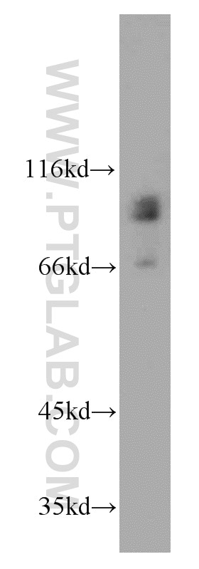 Western Blot (WB) analysis of C6 cells using MGAT5B Polyclonal antibody (16993-1-AP)
