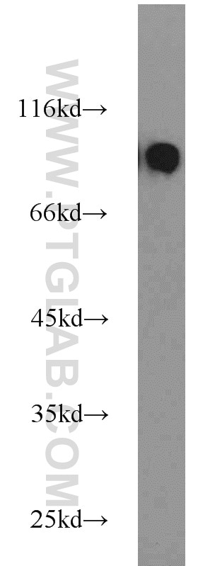 Western Blot (WB) analysis of Jurkat cells using MGAT5B Polyclonal antibody (16993-1-AP)