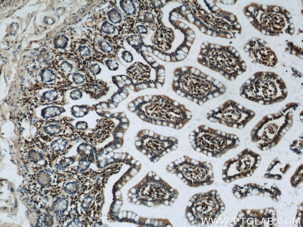 Immunohistochemistry (IHC) staining of human small intestine tissue using MZB1 Polyclonal antibody (11454-1-AP)