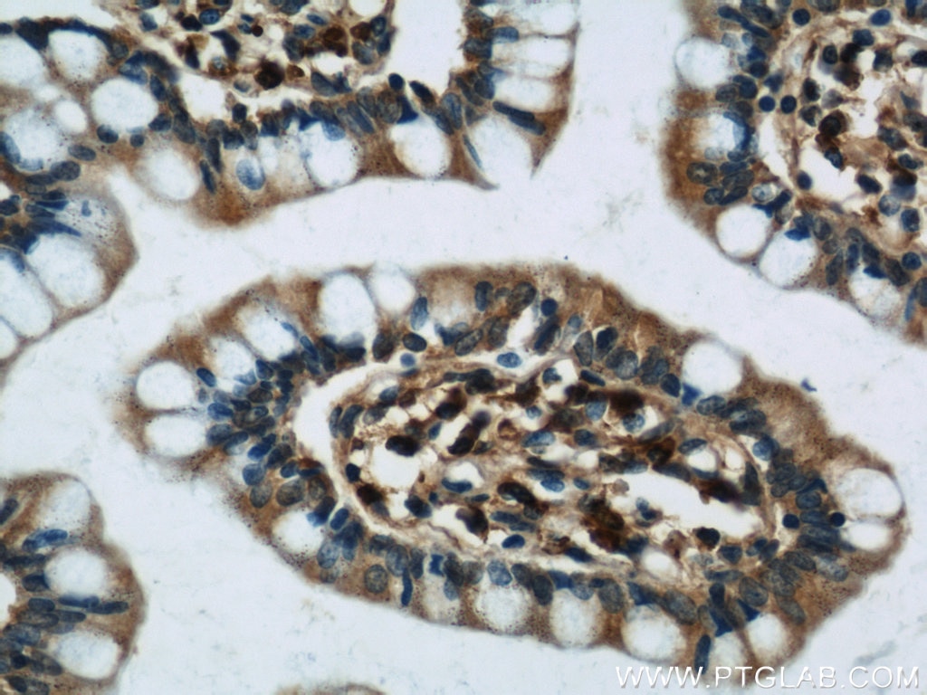 Immunohistochemistry (IHC) staining of human small intestine tissue using MZB1 Polyclonal antibody (11454-1-AP)