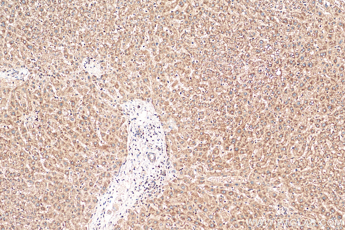 Immunohistochemistry (IHC) staining of human liver tissue using MGC33407/ACTL9 Polyclonal antibody (29885-1-AP)