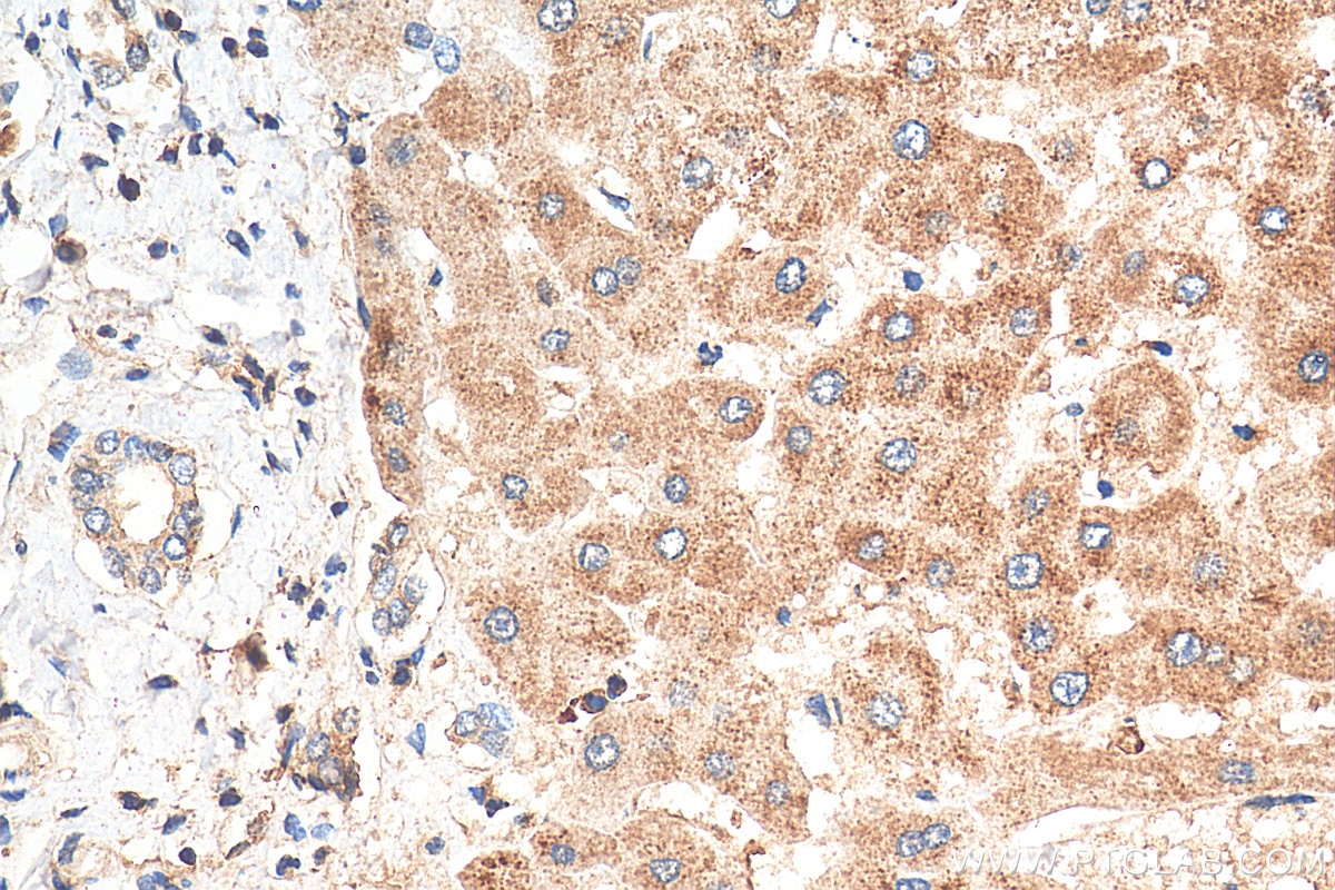Immunohistochemistry (IHC) staining of human liver tissue using MGC33407/ACTL9 Polyclonal antibody (29885-1-AP)