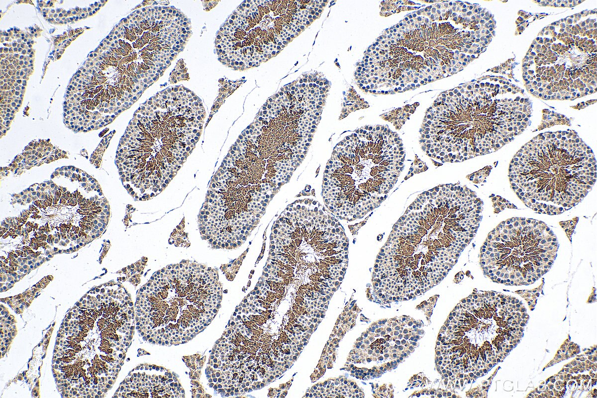 Immunohistochemistry (IHC) staining of mouse testis tissue using MGC33407/ACTL9 Polyclonal antibody (29885-1-AP)