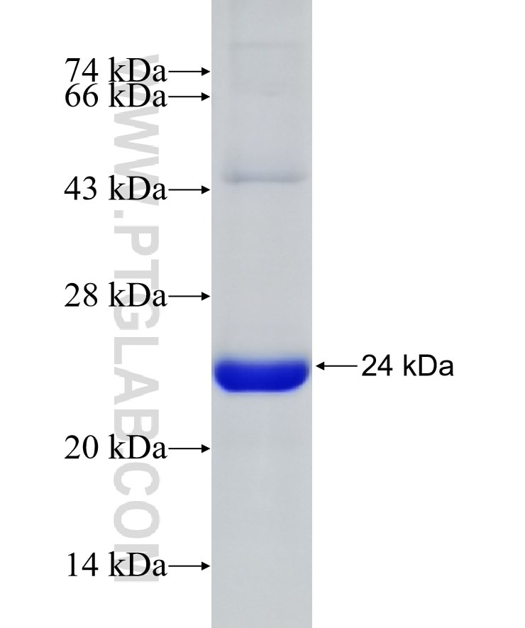 MGC33407 fusion protein Ag31805 SDS-PAGE