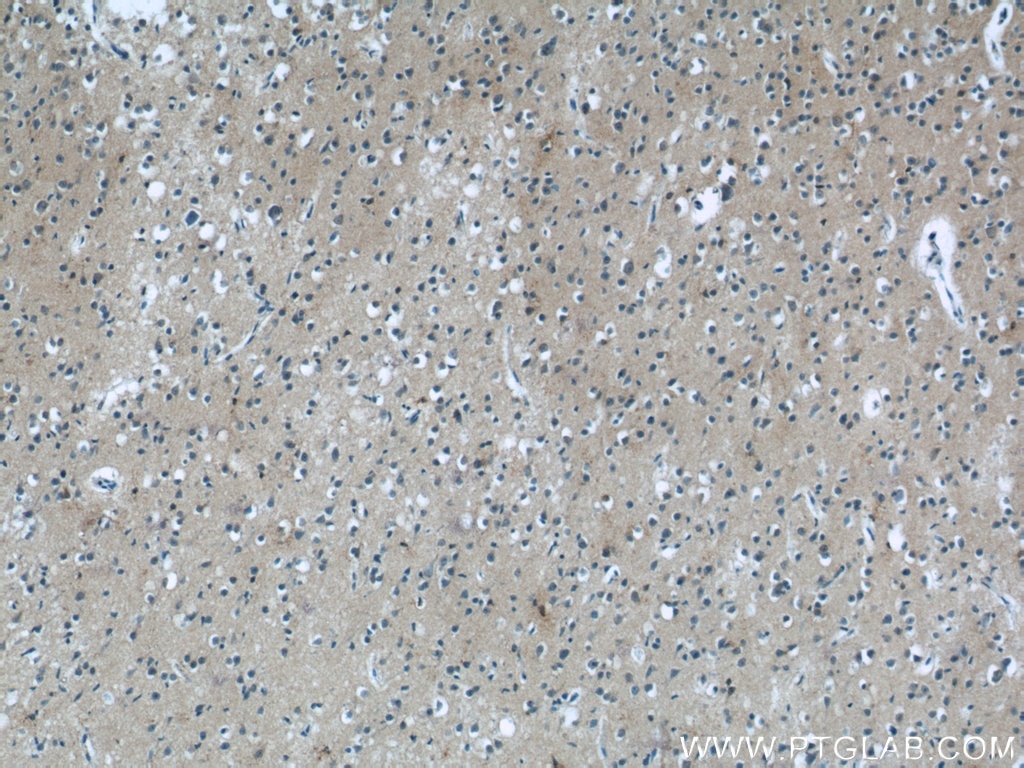 Immunohistochemistry (IHC) staining of human brain tissue using MGC39372 Polyclonal antibody (25403-1-AP)