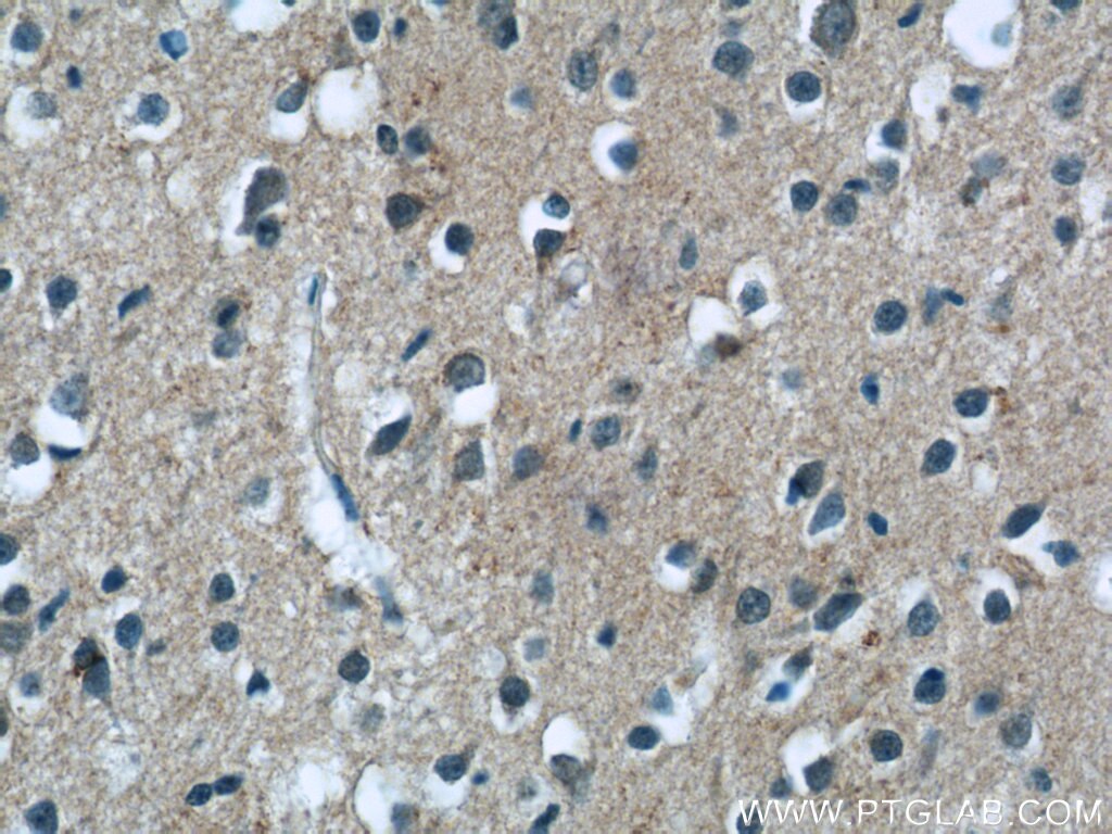 Immunohistochemistry (IHC) staining of human brain tissue using MGC39372 Polyclonal antibody (25403-1-AP)