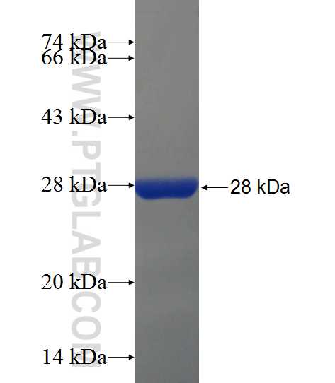 MGC39372 fusion protein Ag21931 SDS-PAGE